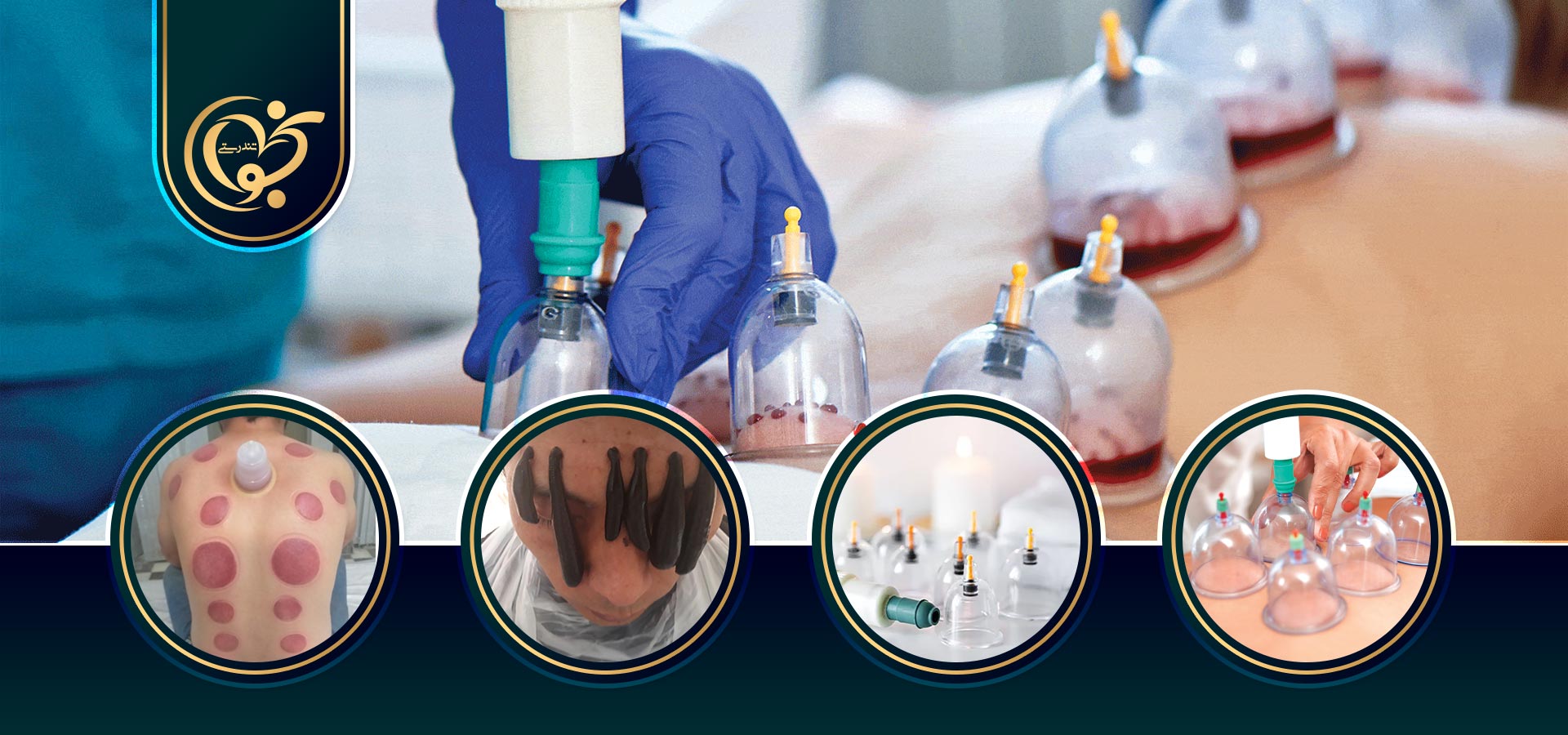 خدمات بادکش نحوای تندرستی