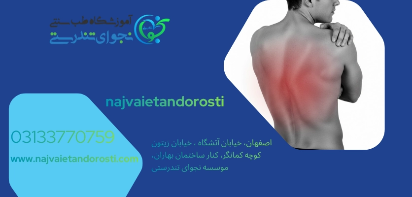 مه فیبرو - بیماری فیبرومیالژیا